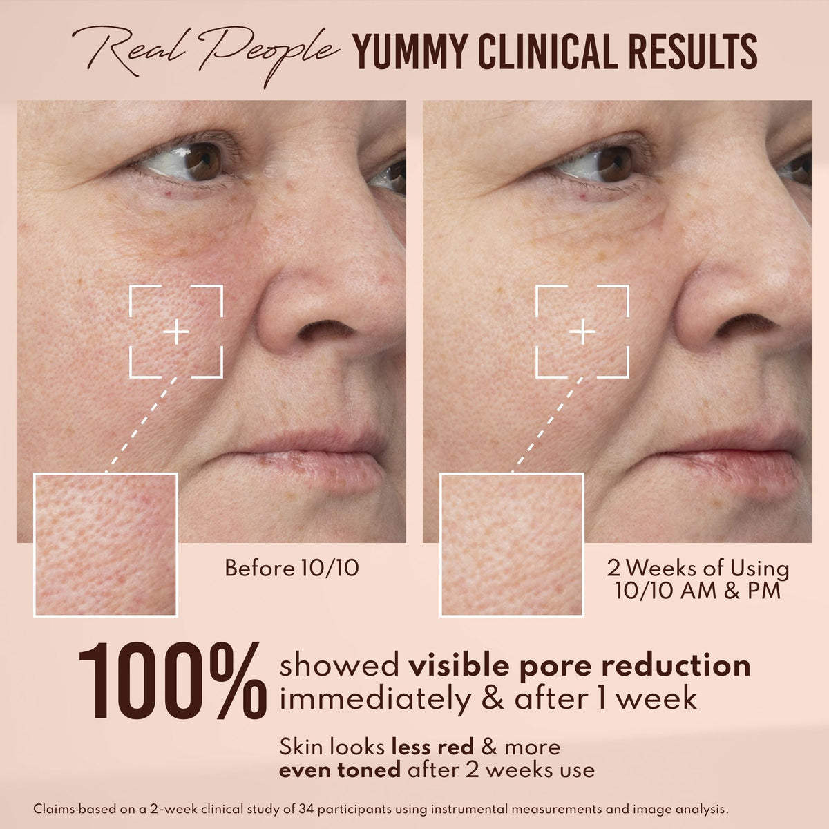 Yummy Skin 10/10 Barrier Boost Hyaluronic Acid + Ectoin Plumping Serum